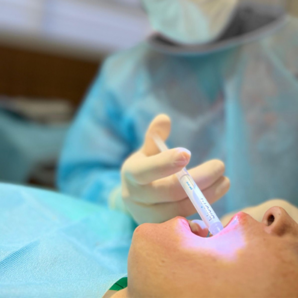 Oral Gel ενεργού οξυγόνου BlueM