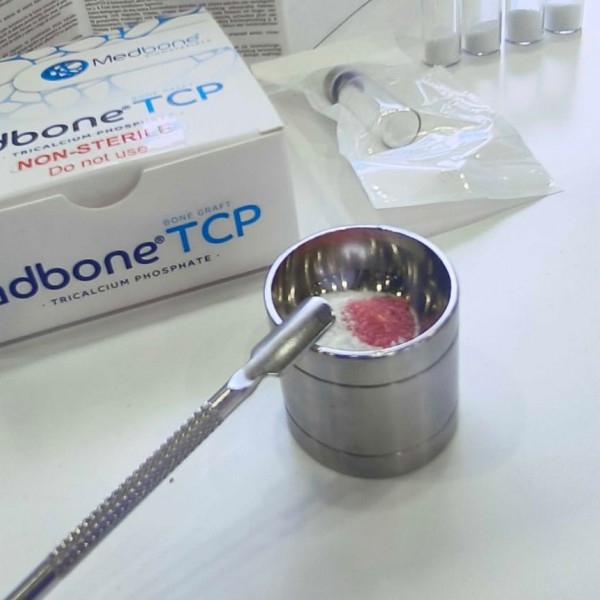 Οστικό μόσχευμα Adbone®TCP από καθαρό β-φωσφορικό ασβέστιο της Μedbone