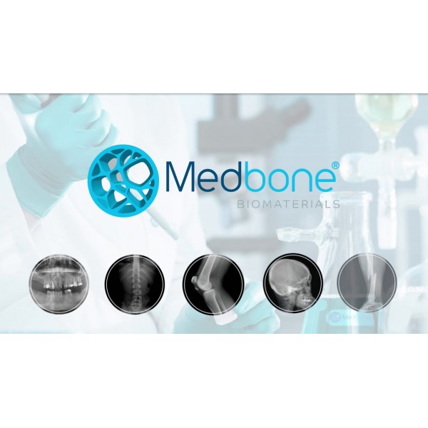 Οστικό μόσχευμα Adbone®TCP από καθαρό β-φωσφορικό ασβέστιο της Μedbone
